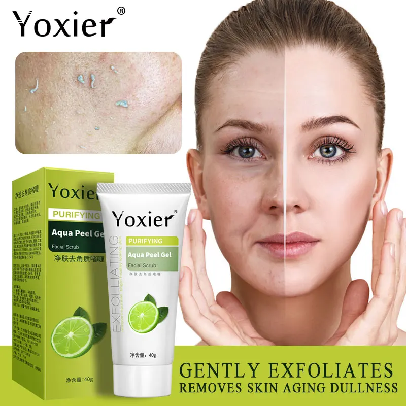 Yoxier Exfoliating Face Scrub Peeling Gel Moisturizing Whitening Lemon Vitamin C Remove Acne Detoxifies And Cleanses All Skin | Красота и