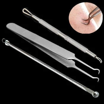 

Rakado Blackhead Acne Comedone Pimple Blemish Extractor Remover Stainless Steel Blemish Pimple Acne Clip Tweezers Skin Care Tool