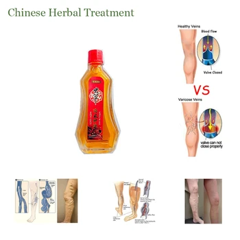

Sciatica Relieve Pain Cordyceps Essential Oils Hyperosteogeny Balm Joints Pain Patches Chinese Herbal Rheumatism Arthritis Care