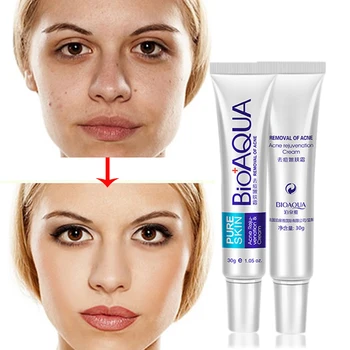 

Bioaqua 30g Acne Rosacea Age Spots Freckles removal Night cream Skin whitening Gel anti bacterial reduce pigmentation