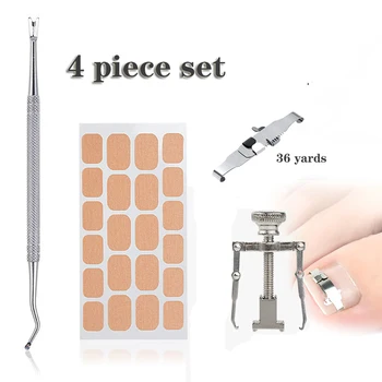 

Nail Ingrown Toenail Correction Set Pedicure Patch Stickers Straightening Brace Inset Buckle Foot Care Correctors Accessories