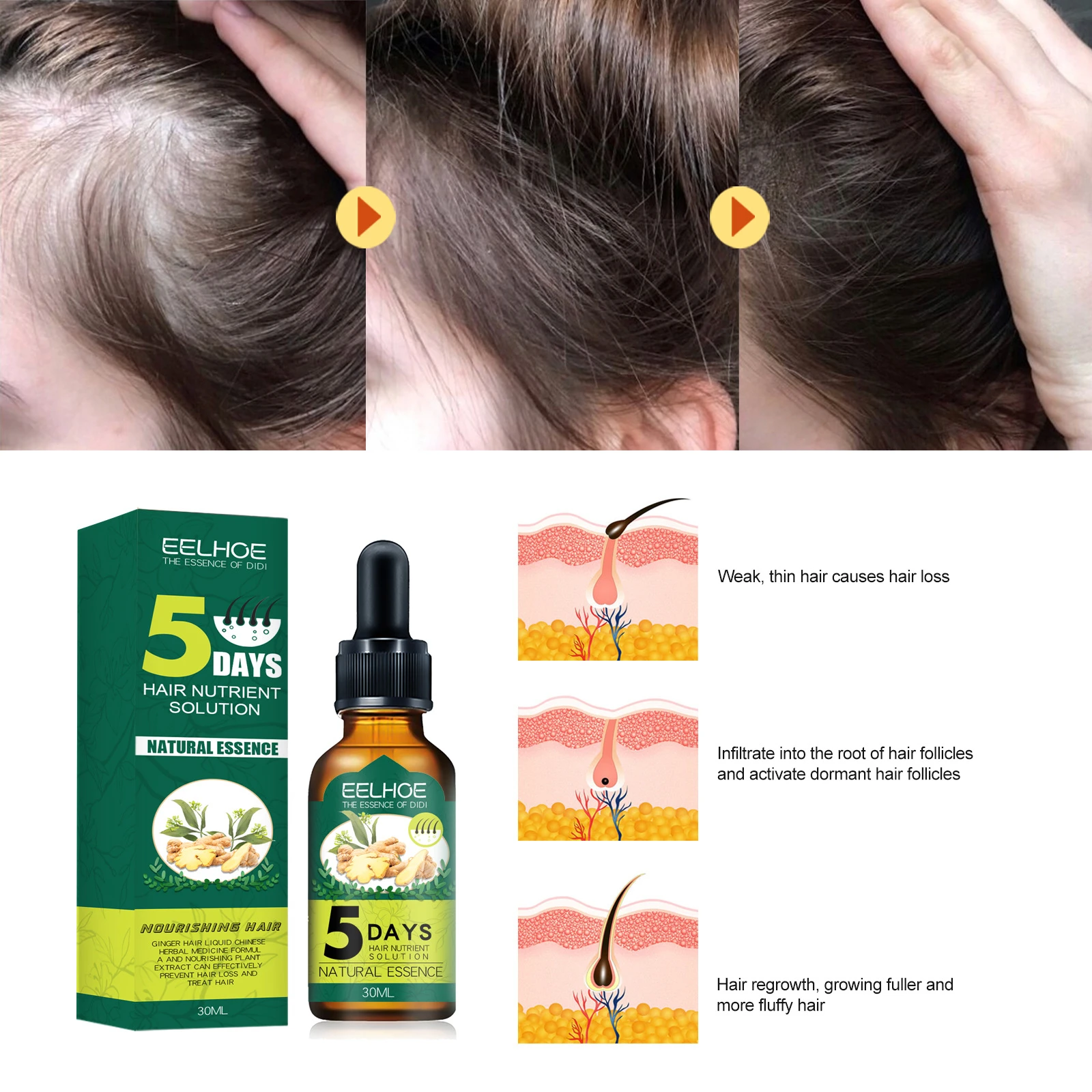 30ml 5 Days Hair Nutrient Solution Essential Oil Raise Make Smoother Dense  Hair Issuance Fast Growth Prevent Hair Loss Care| | - AliExpress