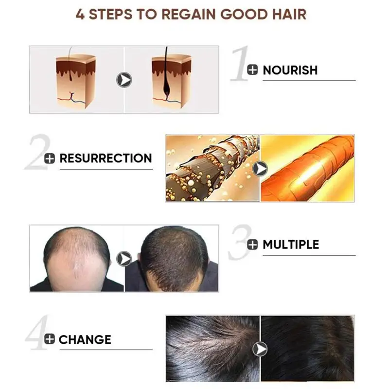 30 мл DISMOI масло для роста волос, средство для предотвращения выпадения волос, натуральное восстановление роста волос, более быстрое восстановление, жидкая сыворотка для волос