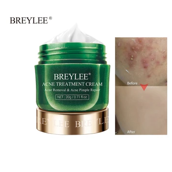 

Face Acne Cream Acne Scar treatment Anti Acne Cleaning Pimple quickly Face Cream Acne Treatment Skin Care Facial Care Tools