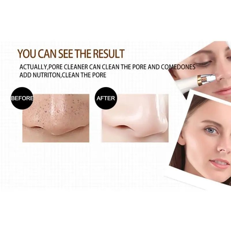 Электрический Очиститель угрей батарея лица пор красота устройство устранения