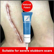 15 г крем для удаления шрамов, крем для лица, крем для удаления шрамов и растяжек, крем для восстановления кожи, крем для лица от прыщей и пятен Ba Ke
