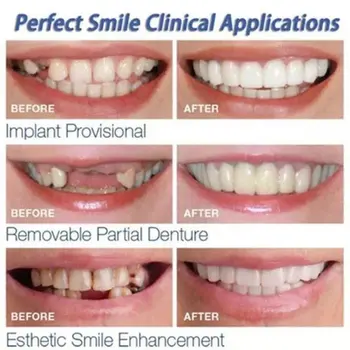 

Beautiful Smile Veneers Teeth Braces Comfort Fit Cosmetic Wear resistance Teeth Denture Teeth Simulation braces