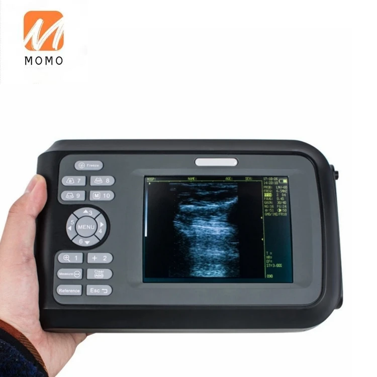 Рисунок 4 - Портативный Ветеринарный ультразвуковой