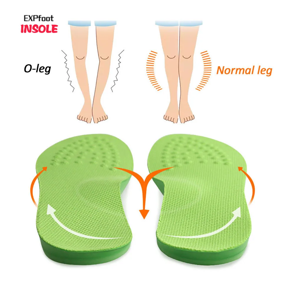 

EXPfoot O/X-Leg Orthopedic Insoles Arch support insole corrigibil Bow Legs Valgus Varus Massaging Shoe pads Beauty Leg Feet Care