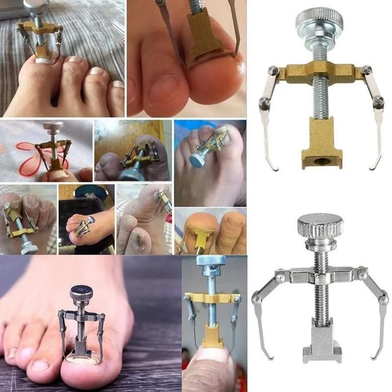 Stainless Steel Nail Art Correction Tool Of Foot Toe Nails Meat Claws Ingrown Orthosis Pedicure Tools Feet Corrector Health Care