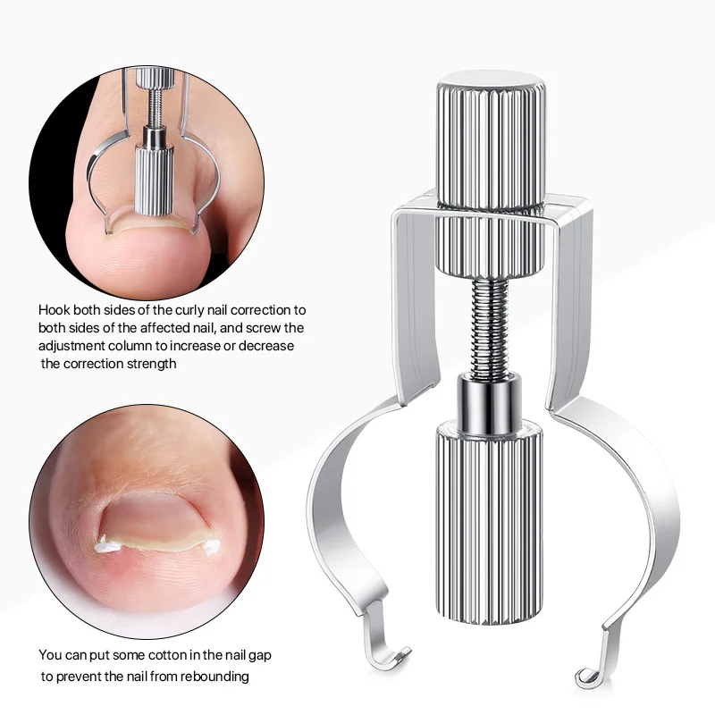 Ingrown Toenail Corrector Ingrown Toenail Lifter Ingrown Toenail Tool Toe Clamp Stainless Steel Foot Care Tool for Paronychia 188 288mm stainless steel labor saving arm height adjustable lifter handheld lift positioning pad woodworking clamp lift tools