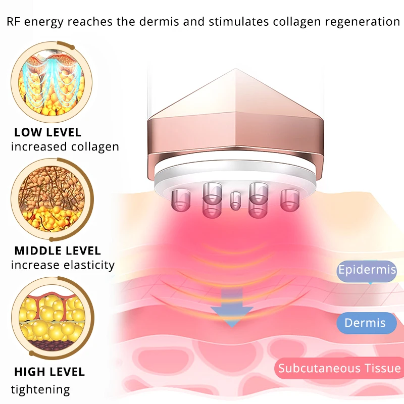 Термаж лица RF радиочастота для лифтинга лица, подъема кожи тела, удаления морщин, подтяжка Красота Уход Массажер