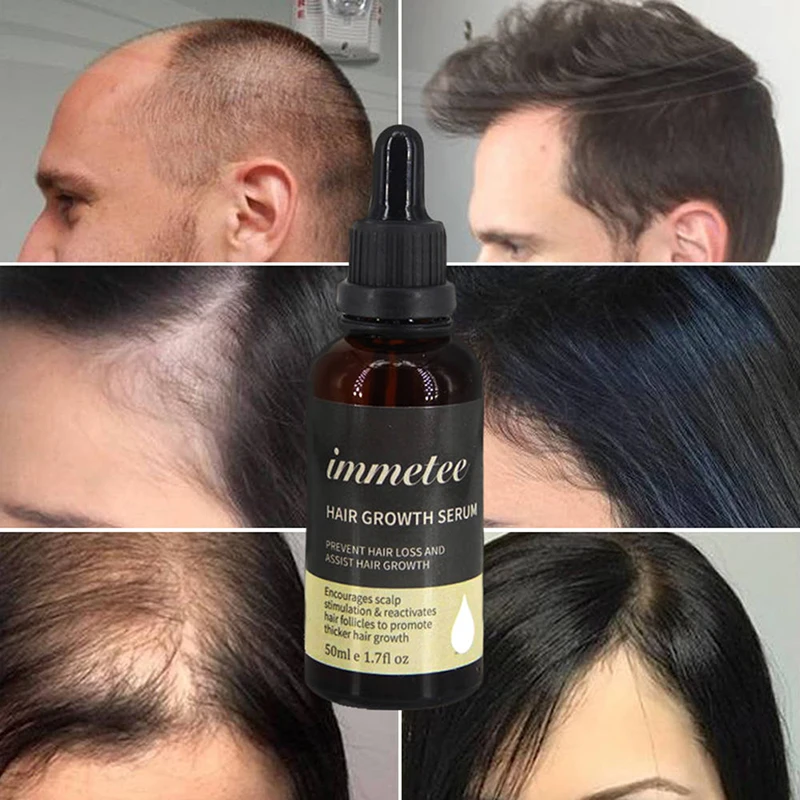 Натуральный Тоник для роста волос эфирное масло для роста волос жидкость питательные волосы, кожа головы против выпадения волос травяная Эфирная жидкость