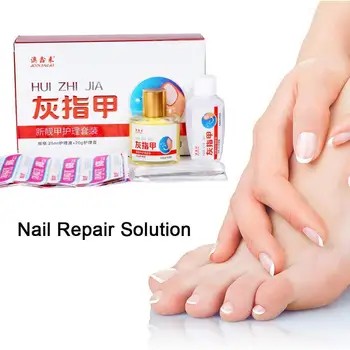 

Nail Repair Solution Remove Toe Onychomycosis Remover Fungus Serum Treatment Care Nail Nail Repair C4T0