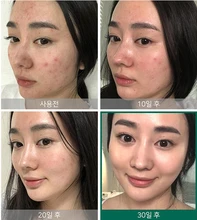 snail truecica essence