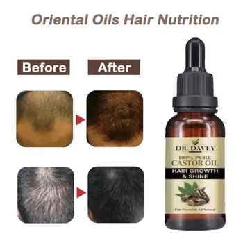 

Hair Growth Oil Anti Hair Loss Thinning Balding Repairs Hair Follicles Promotes Thicker Stronger Promotes Regrowth Hot