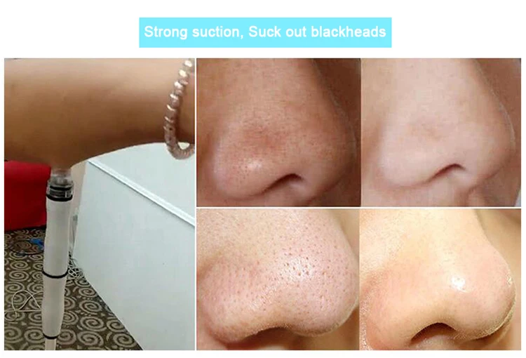 2018 new updated Face Rejuvenation skin lifting aqua facial machine skin care dermabrasion aqua machine peel