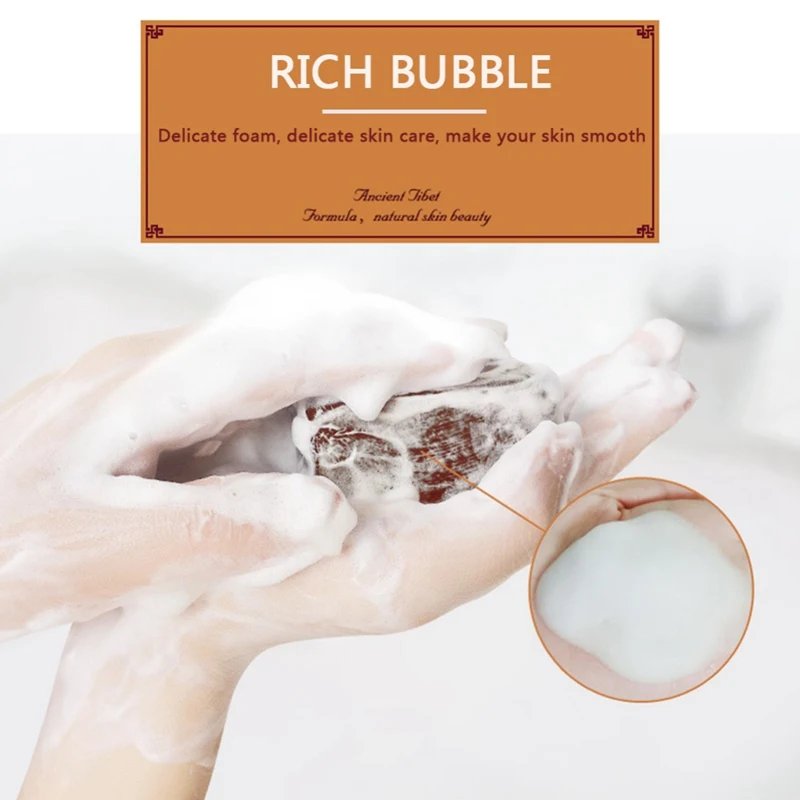 100 г тибетское мыло, увлажняющее масло-контроль против акне, против клещей, укрепляющее кожу, травяное мыло, уход за кожей лица