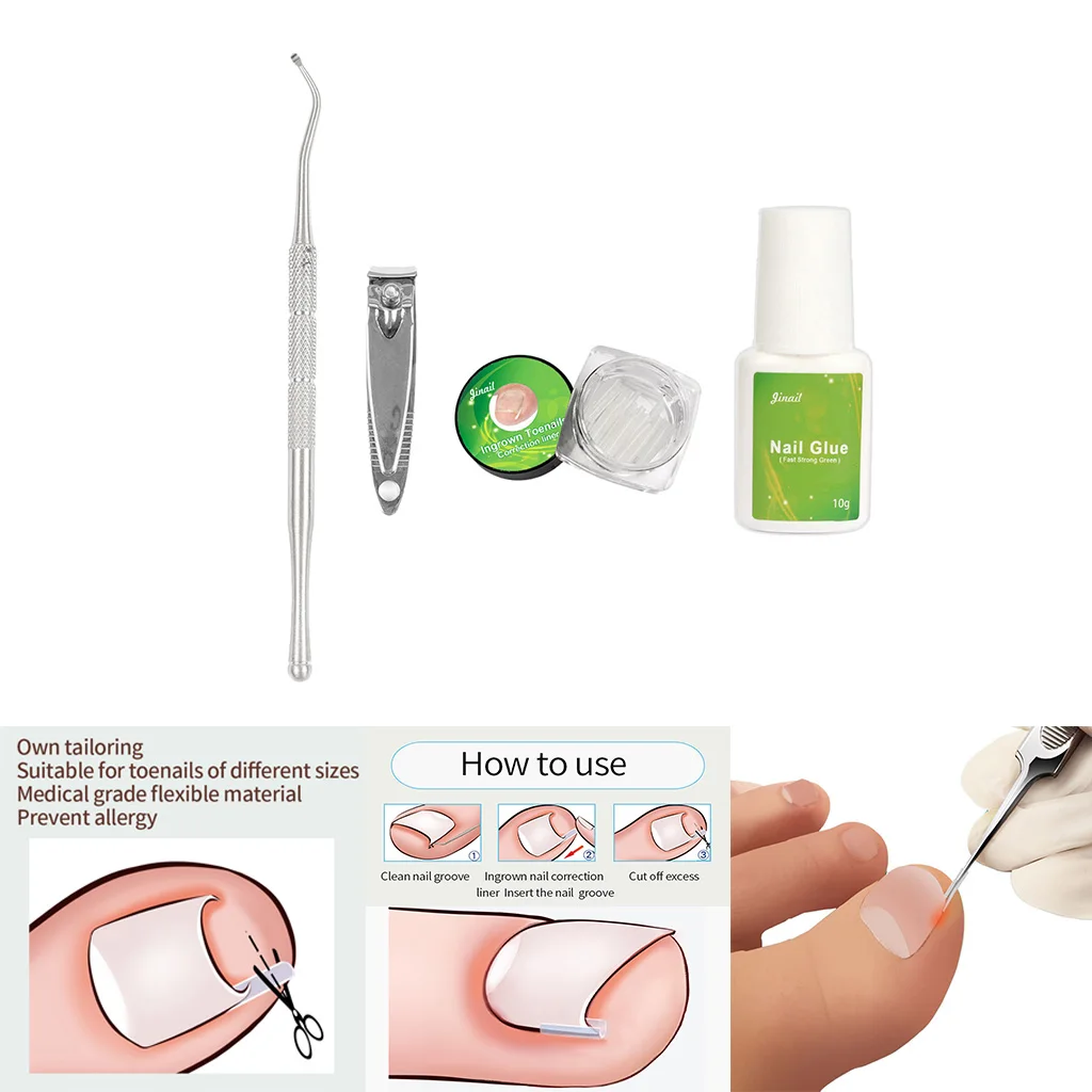 Toe Nail File Foot Nail Care Ingrown Double Ended Ingrown Toe Correction Lifter File with Glue Manicure Pedicure Toenails Tool