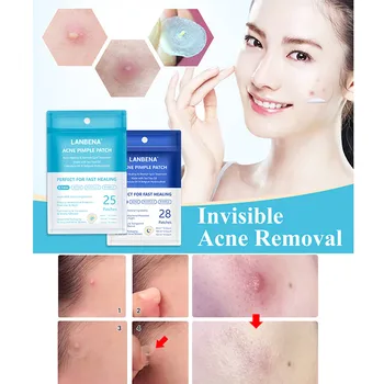 

Patch Acne Pimple Master Invisible Stickers Skin Face Spot Scar Care facial skin care blackhead removal Freckle acne mask #1223