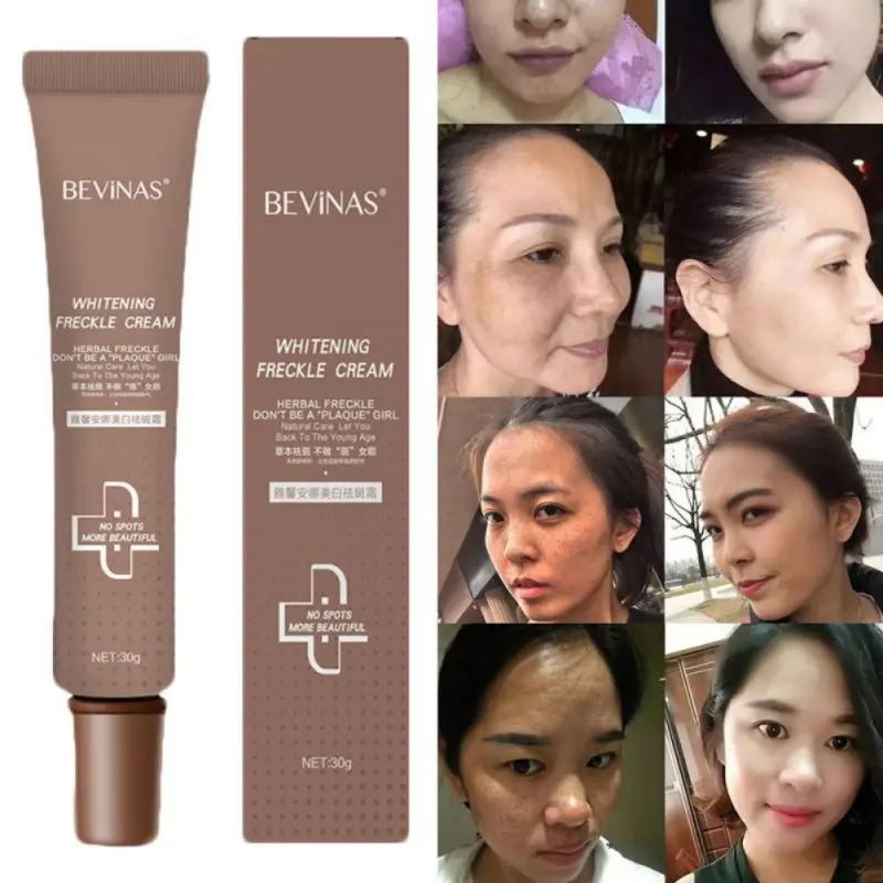 Whitening Freckle Cream Moisturizing Lighten Melanin Brighten Skin Color Freckle Removal Cream