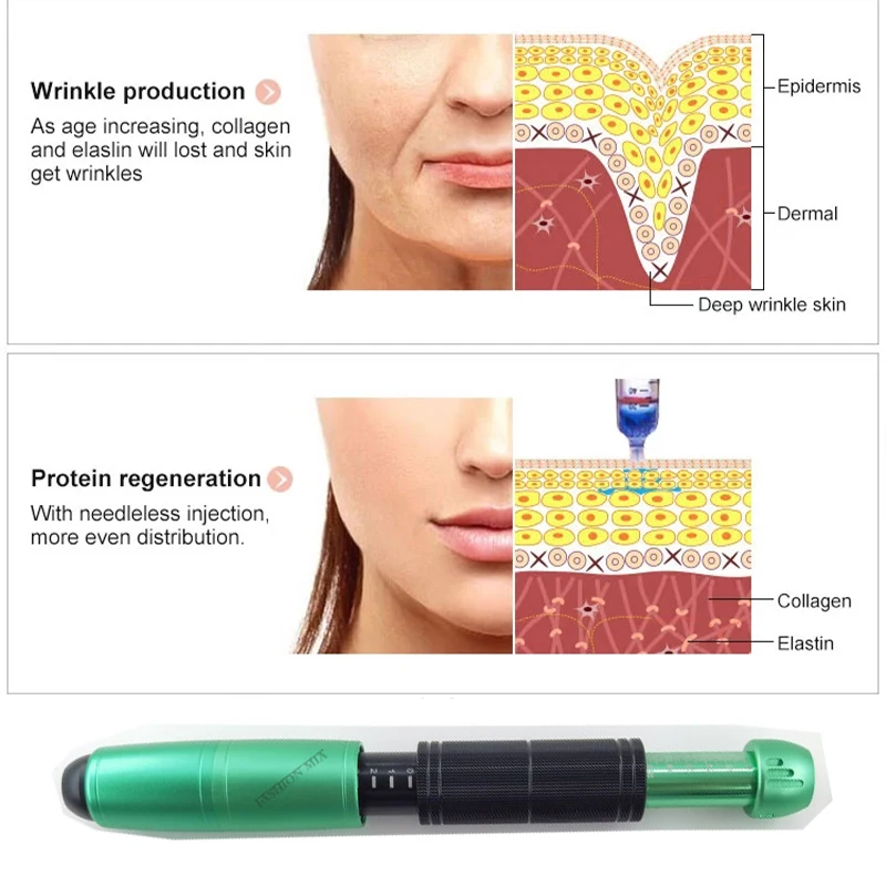 0.3&0.5ml Gun Lip Filler Hyaluronic Pen Stainless Steel Spiral Pressurized Pen Wrinkle Ance Remove Body