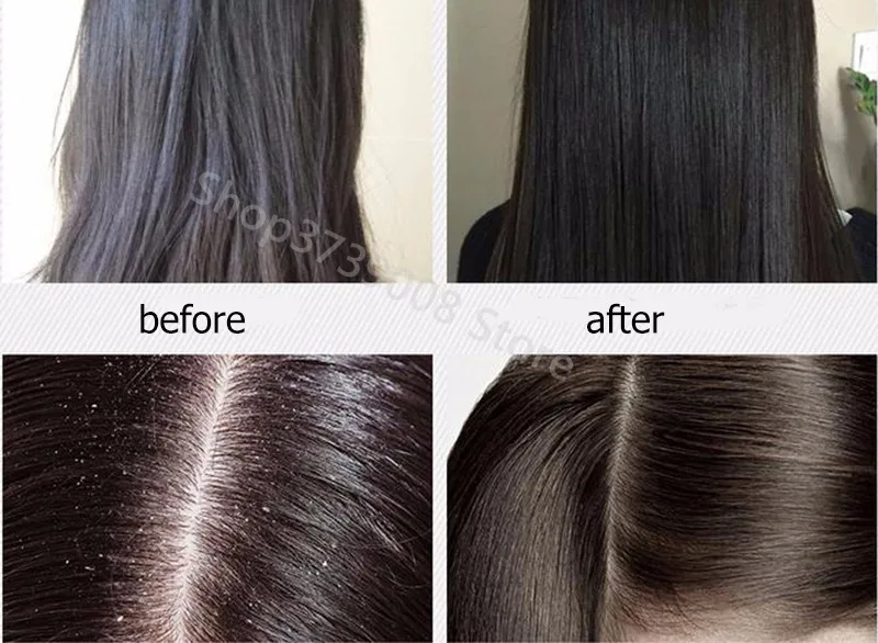 HTB1QdrpbljTBKNjSZFDq6zVgVXaX