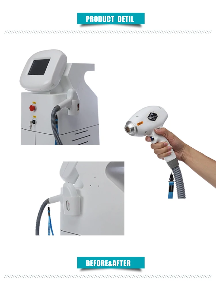 Профессиональный вертикальный косметический лазер opt IPL ремонт 808nm удаление волос лазерная машина