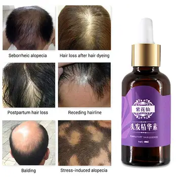 

20ml Hair Loss Treatment Products Natural With No Side Hair Hair Oil Faster Essence Grow Growth Effects Regrowth Products I5R3