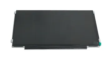 

Replacement for ACER ASPIRE M3-581G LED LCD Screen New Matrix for Laptop 15.6" eDP Display