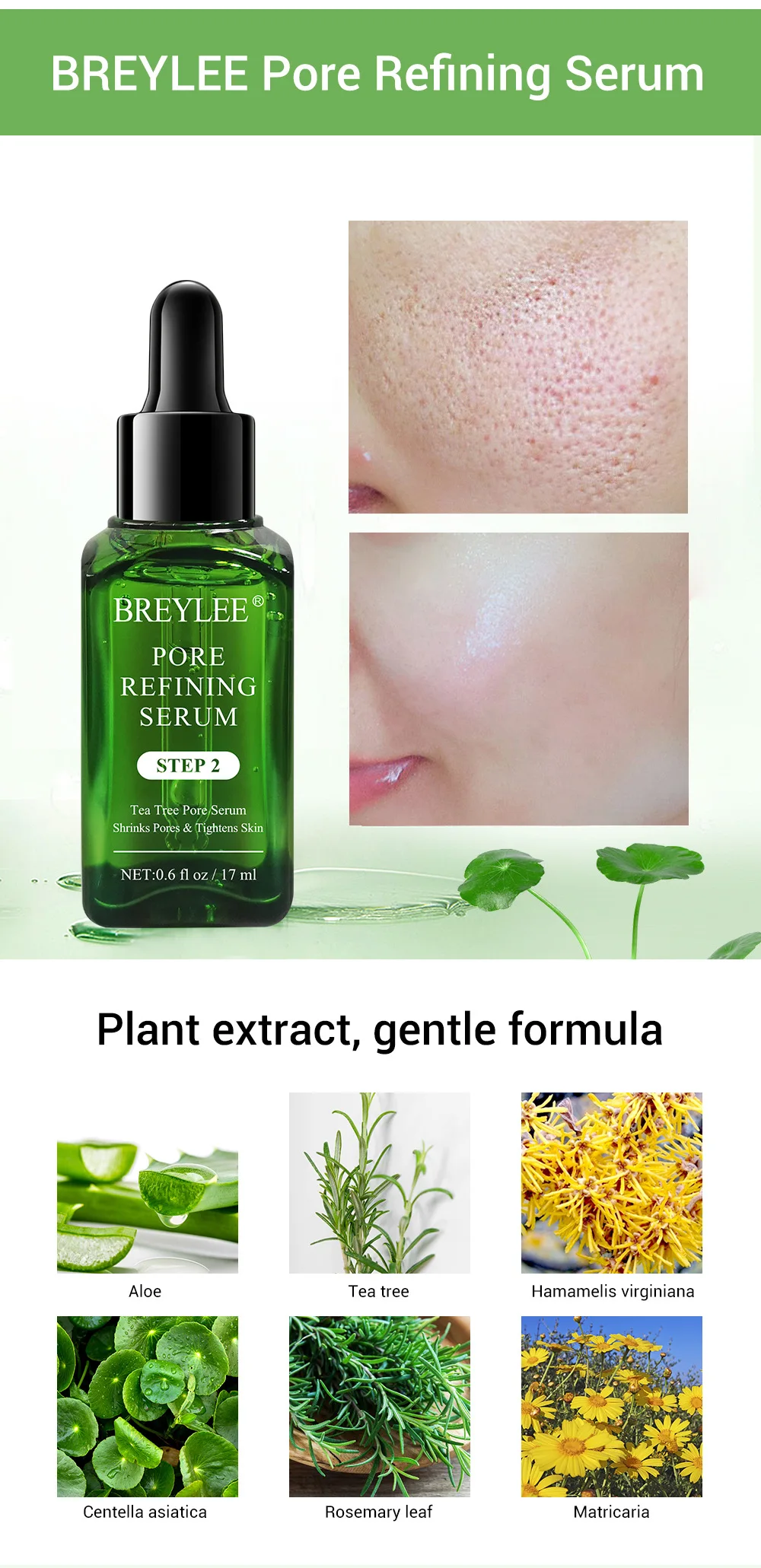 Blackhead Remover Peel Off Nose Mask Face Serum For Anti Acne Treatment Black Head Removal Pore Refining Serum Shrinks Pore Kit 005