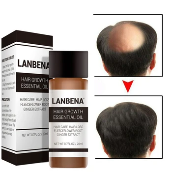 

20ml fast and powerful hair growth essence essential oil products to treat essential oils to prevent hair loss and hair care