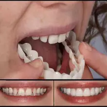 Dentes brancos conjunto de dentes falsos snap-on dentadura branco brilhante aparelho de dentista equipamento de cuidados orais ferramenta de branqueamento dentes folheado