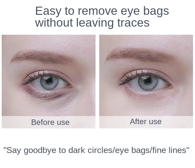 Terapia de Luz Cuidados com os Olhos Portátil Elétrica Aquecida Vibração Olho Beleza Massagem Caneta Rugas Remover Massageador Vermelha Ferramenta Alívio Fadiga 15 caneta rugas remover massageador terapia de luz