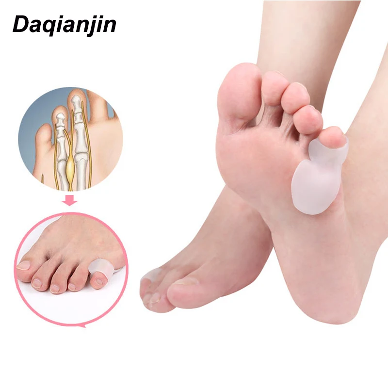 2 шт., силиконовый разделитель для пальцев ног, для вальгусной деформации