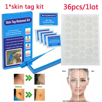 

1set Skin Tag Remover Kit+36pcs/lotAcne Patch Invisible Pimple Patch Treatment Pimple Cover Blackhead Patch Removal Wart Remover