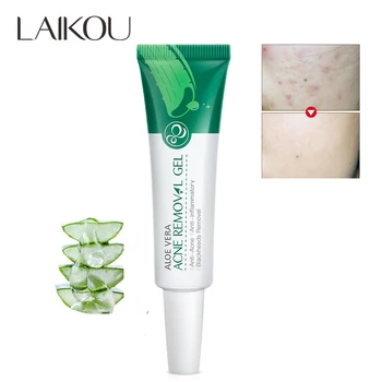 

LAIKOU Aloe Soothing Gel Anti Inflammatory Anti Acne Treatment Redness Sun Repair Aloe Gel Hyaluronic Acid Natural Facial Cream