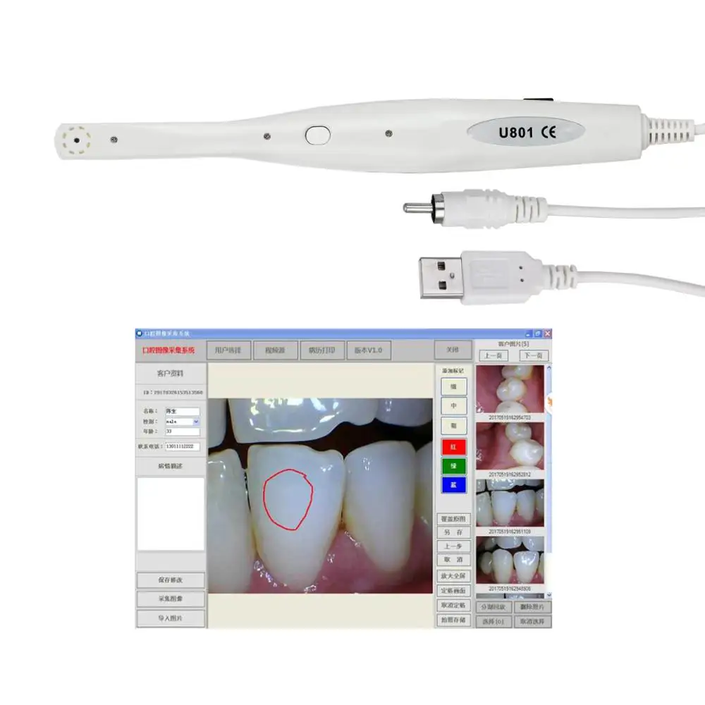  8 LED Light Dentist Oral Endoscope Dental Lab Clinic Intraoral Camera Scanner Teeth Monitoring Insp - 4000336727447