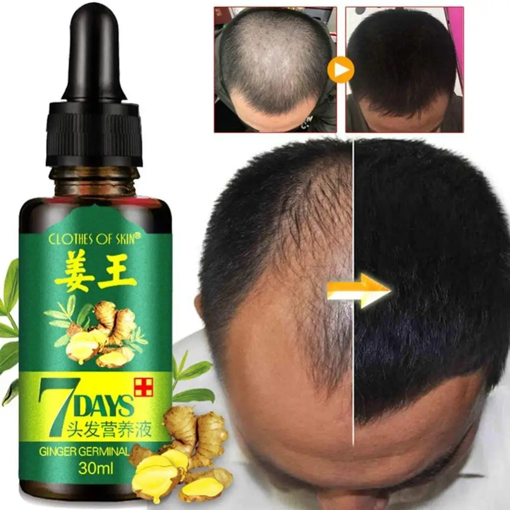 Питательный раствор для волос имбирь герминовая сыворотка естественное лечение выпадения волос эффективный быстрый рост Уход за волосами рост