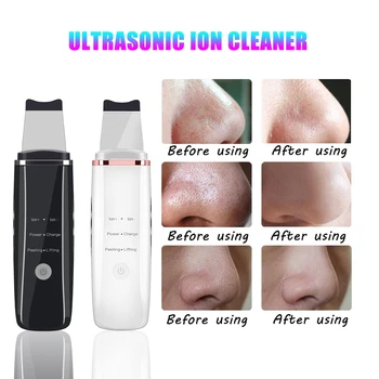 

InFace Ultrasonic Skin Scrubber Cleaner Ion Acne Blackhead Remover Peeling Shovel Cleaner Facial Massager