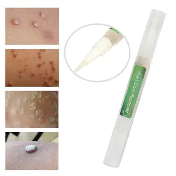 

Body Warts Treatment Cream Skin Tag Remover Wart Corn Foot Light Remover Net Cream 3ml Patch Corns Flat Care Wart Foot D3B5