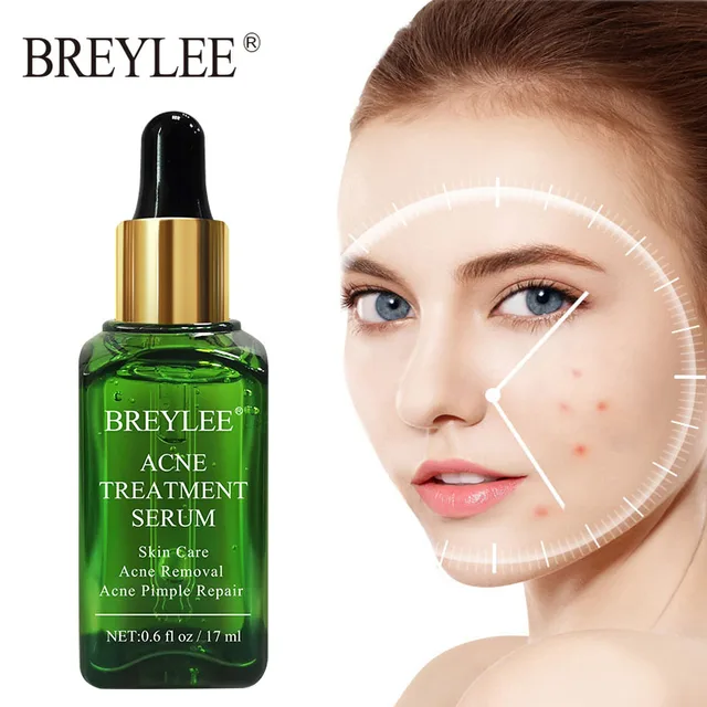 BREYLEE Acne Treatment Face Serum Anti Acne Pimple Scar Remover Moisturizing Oil-Control Whitening Shrinking Pores Essence 1