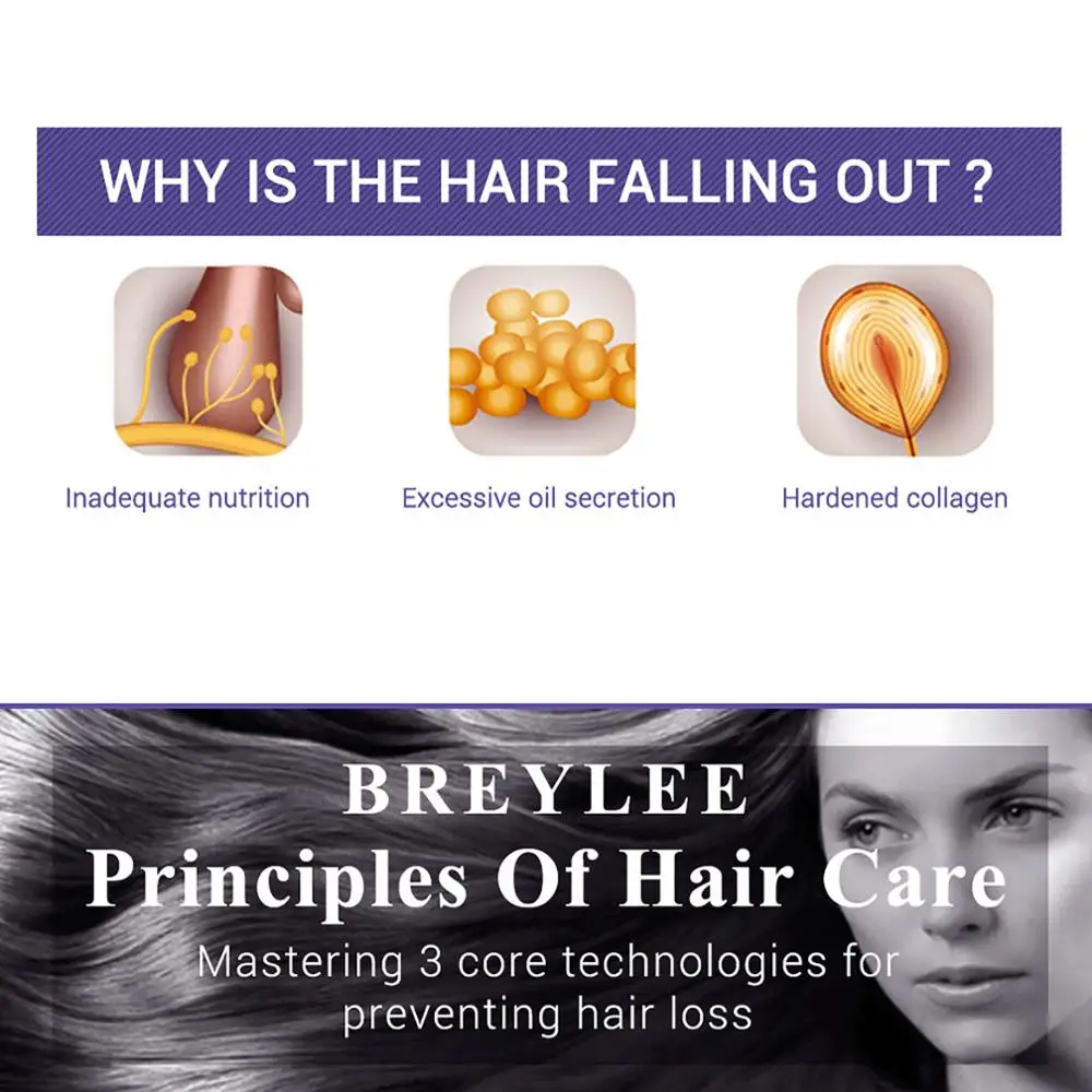 BREYLEE 20 мл имбирный Уход за волосами эфирное масло против выпадения волос Быстрый мощный Уход за волосами Предотвращение облысения