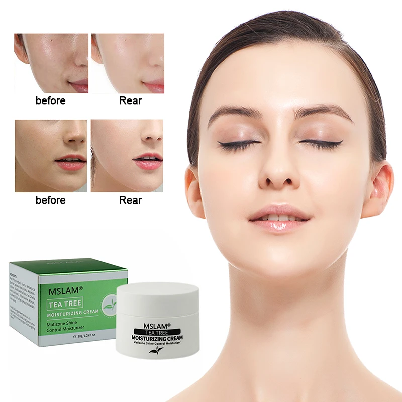 

Tea Tree Anti-Acne Face Cream Acne Scar Cream Shrink Pores Face Eliminates Acnes Cream Oil Control Repair Spot Face Care TSLM1