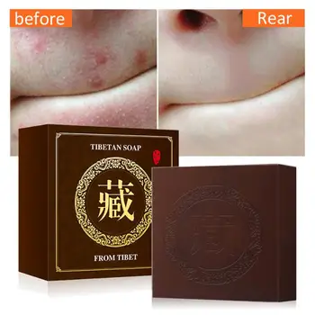 

Tibetan Handmade Soap Rose Essential Oil Cleansing Bath Soap Moisturizing Refreshing Oil Control Clean Skin Mites Skin Care TSLM