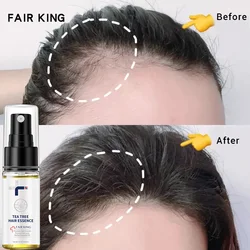 Hair Growth Spray Essential Oils Fast Growing Hair Care Anti Hair Loss Oil  Prevent Hair Thinning Scalp Treatment Men Women
