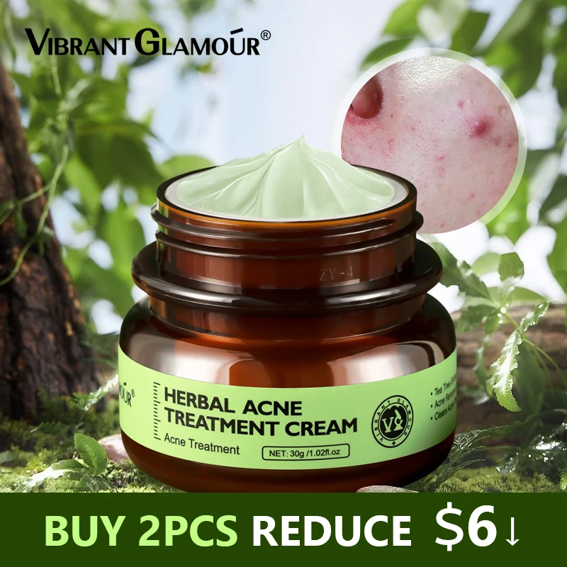 VIBRANT GLAMOUR Herbal Acne Treatment Cream Oil Control Brighten  Nourish Whitening Shrink Pores Remove Scars Marks Skin Care30g