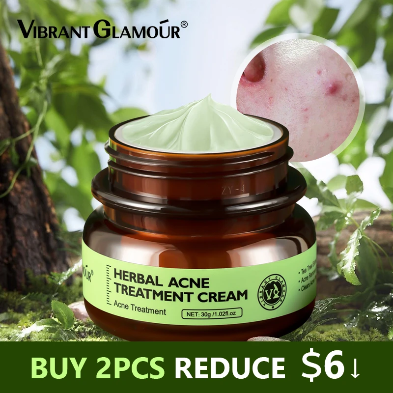 Vibrant Glamour Herbal Acne Treatment Cream Oil Control Brighten