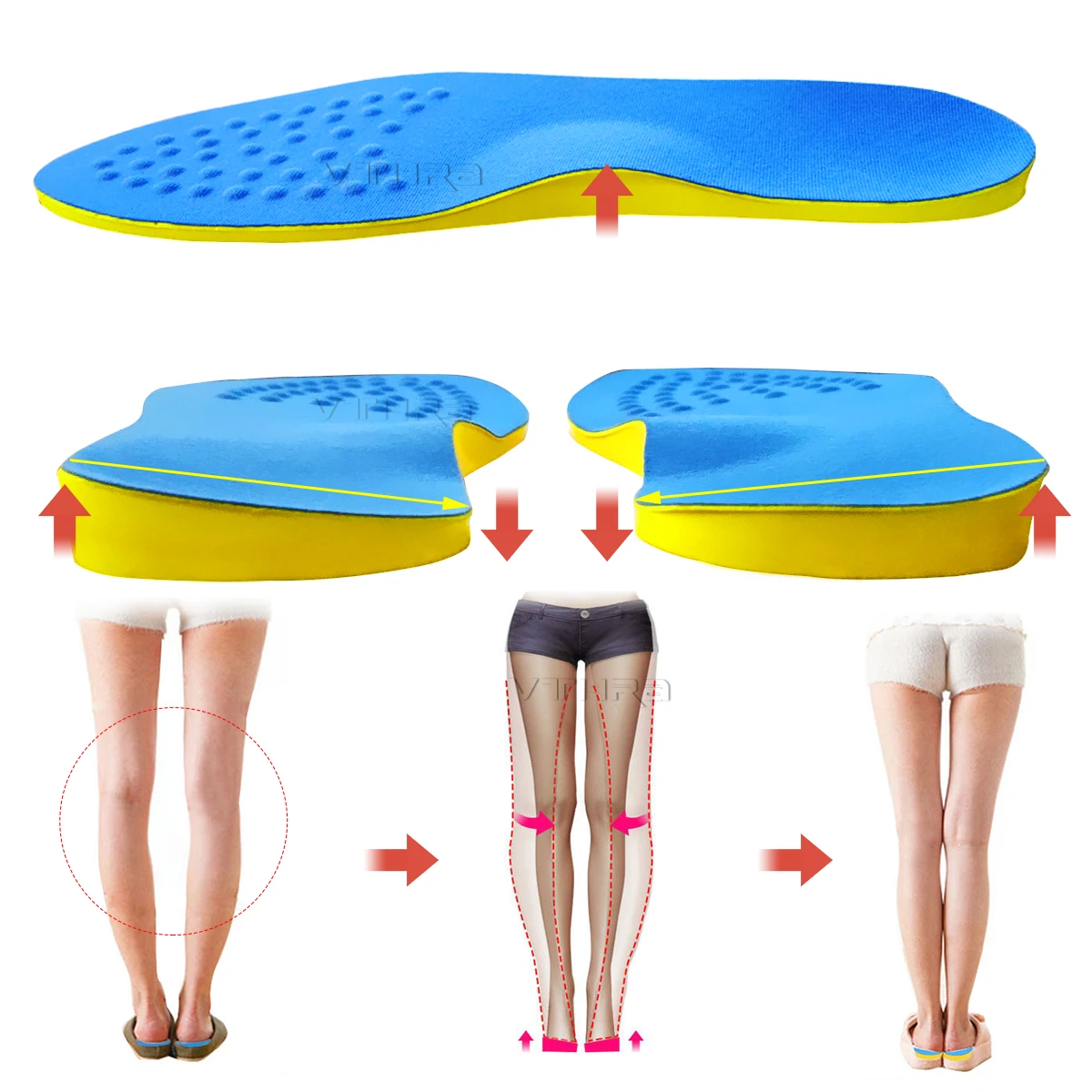 1 Pair O/x Leg Orthopedic Insoles Correction Shoe Inserts For Foot Alignment Knock Knee Pain Bow