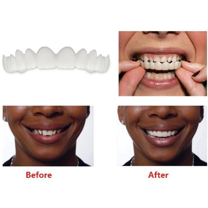 

1PC Cosmetic Dentistry Snap On Smile Instant Perfect Smile Comfort Fit Flex Teeth Fits Most False Teeth Upper Tooth Cover